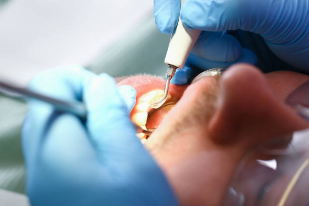 Best Cosmetic Emergency Dentistry in Columbus, KS