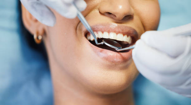 Best Emergency Root Canal Treatment in Columbus, KS