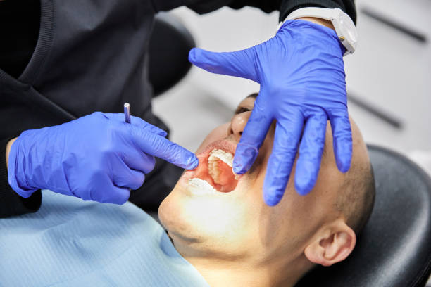 Best Emergency Treatment for Dental Infections or Abscesses in Columbus, KS